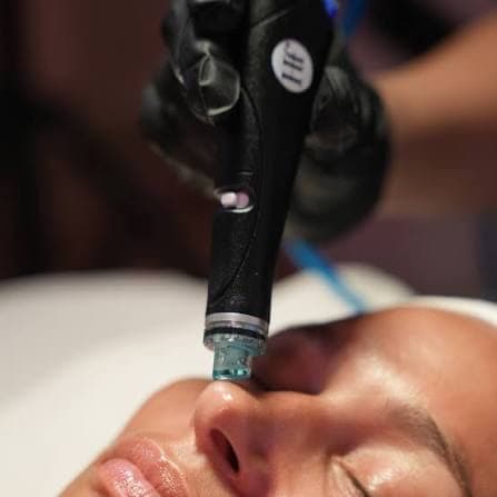 Deluxe Hydrafacial package at Estetica Venice